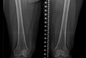 Escanometria e Panorâmica MMII - Gerador de Laudos - escanometria radiologia online