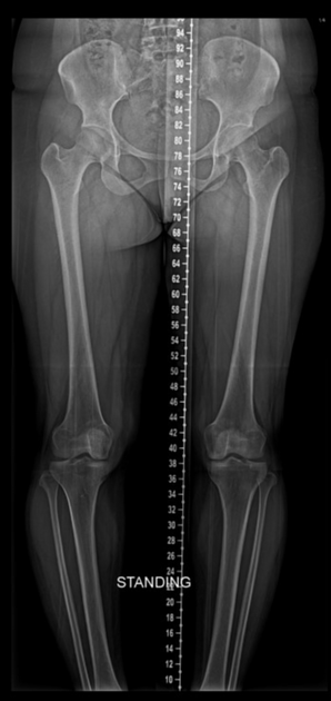 Escanometria e Panorâmica MMII - Gerador de Laudos - escanometria radiologia online