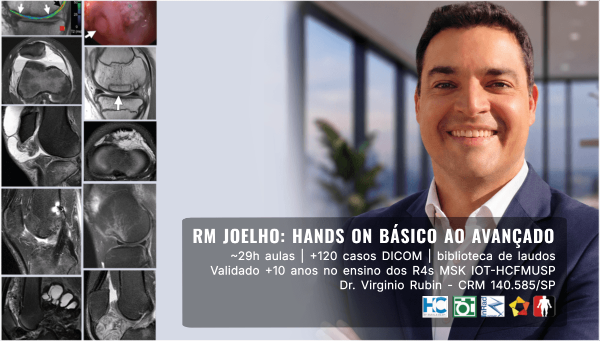RM JOELHO: HANDS ON BÁSICO AO AVANÇADO
